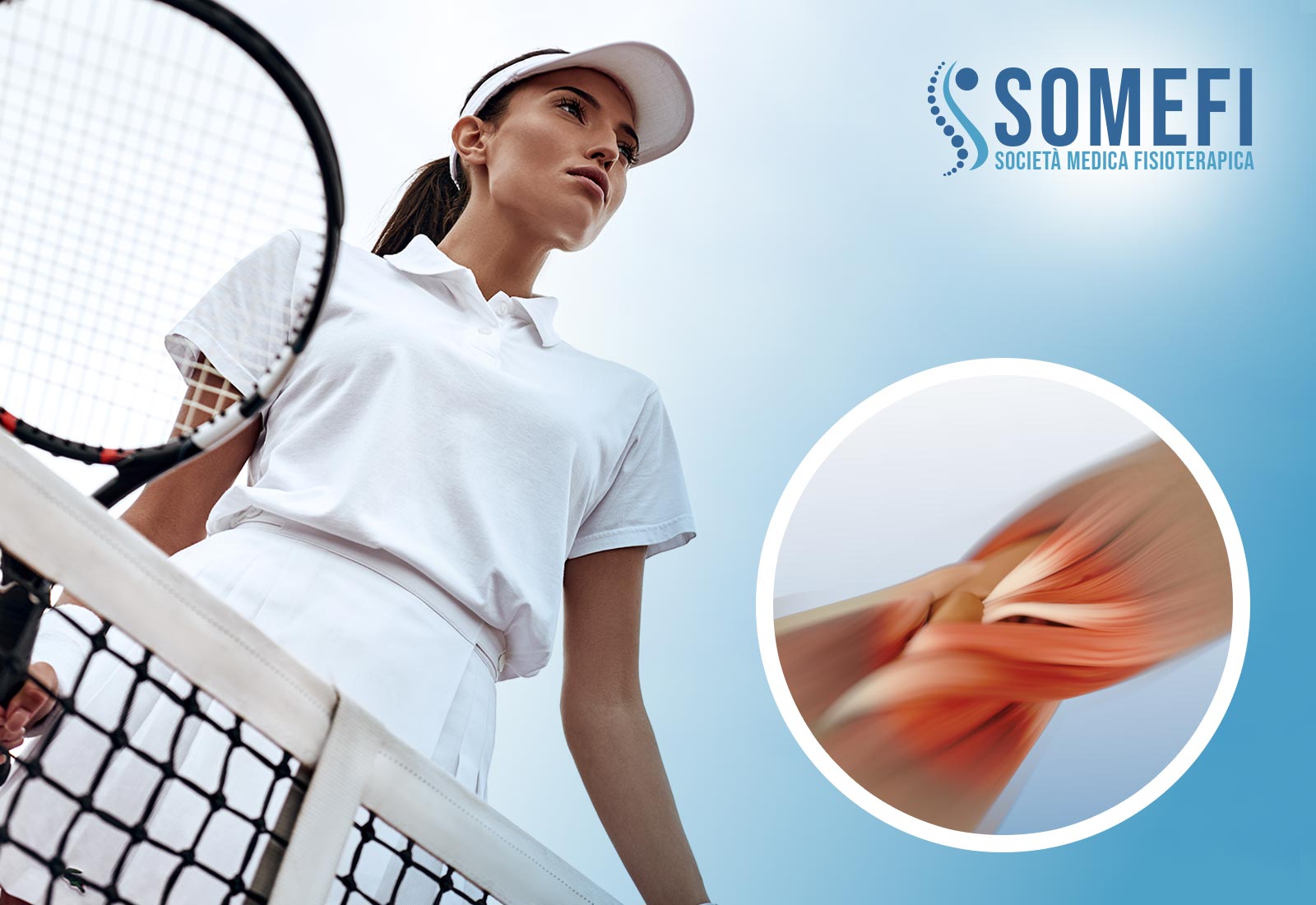 Gomito del tennista: cause e rimedi - Centrosomefi.it